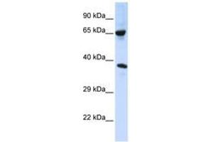 Image no. 1 for anti-Chromosome 6 Open Reading Frame 134 (C6orf134) (AA 108-157) antibody (ABIN6740781) (Chromosome 6 Open Reading Frame 134 (C6orf134) (AA 108-157) 抗体)