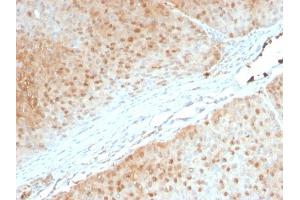 Formalin-fixed, paraffin-embedded human Pancreas stained with AKT1 Mouse Monoclonal Antibody (AKT1/2552).