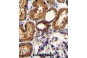 WT1 Antibody (Center E361) immunohistochemistry analysis in formalin fixed and paraffin embedded human kidney tissue followed by peroxidase conjugation of the secondary antibody and DAB staining. (WT1 抗体  (Middle Region))