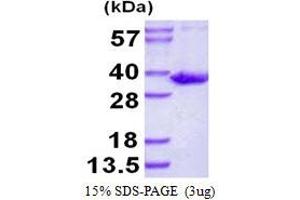 Image no. 1 for Sulfotransferase Family 1B Member 1 (SULT1B1) protein (His tag) (ABIN1098281)