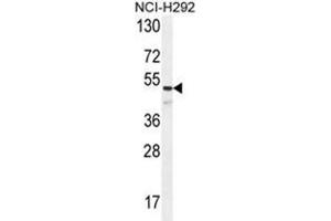 ANGPT1 Antibody (C-term) western blot analysis in NCI-H292 cell line lysates (35µg/lane). (Angiopoietin 1 抗体  (C-Term))
