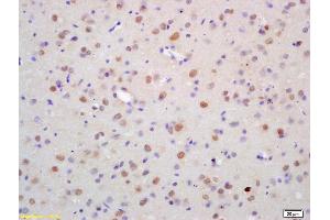 Formalin-fixed and paraffin embedded rat brain labeled with Anti-ZNF312 Polyclonal Antibody, Unconjugated (ABIN1386712) at 1:200 followed by conjugation to the secondary antibody and DAB staining (FEZF2 抗体  (AA 10-120))