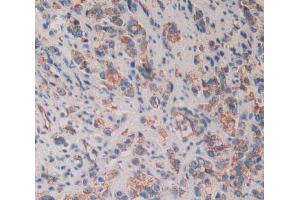 Used in DAB staining on fromalin fixed paraffin- embedded prostate gland cancer tissue (CD109 抗体  (AA 1146-1390))