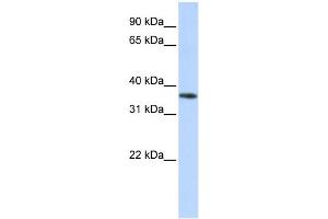 Western Blotting (WB) image for anti-Olfactory Receptor, Family 13, Subfamily C, Member 5 (OR13C5) (Middle Region) antibody (ABIN2777357)