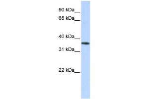 WB Suggested Anti-OR13C5 Antibody Titration: 0. (OR13C5 抗体  (Middle Region))