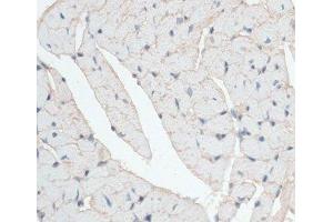 Immunohistochemistry (Paraffin-embedded Sections) (IHC (p)) image for anti-Dystrophin (DMD) antibody (ABIN7008615)