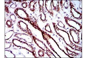 Immunohistochemical analysis of paraffin-embedded kidney tissues using RPL18A mouse mAb with DAB staining. (RPL18A 抗体  (AA 50-176))