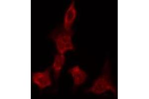 ABIN6269326 staining A549 by IF/ICC. (GRIN1/NMDAR1 抗体  (C-Term))