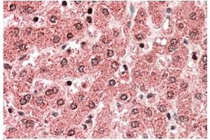 AP22390PU-N ALDH5A1 antibody staining of paraffin embedded Human Liver at 5 µg/ml. (ALDH5A1 抗体  (Internal Region))