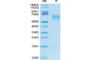 Canine CD28 on Tris-Bis PAGE under reduced condition. (CD28 Protein (CD28) (AA 18-153) (mFc Tag))