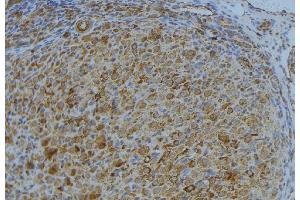 ABIN6276697 at 1/100 staining Human uterus tissue by IHC-P. (TIMP3 抗体  (Internal Region))