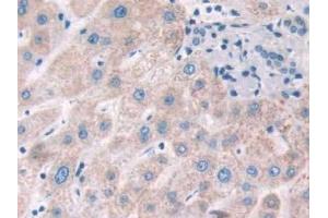 Detection of FLNa in Human Liver Tissue using Polyclonal Antibody to Filamin A Alpha (FLNa) (Filamin A 抗体  (AA 2-274))