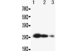 Anti-TIMP3 antibody, Western blotting Lane 1: Recombinant Human TIMP3 Protein 10ng Lane 2: Recombinant Human TIMP3 Protein 5ng Lane 3: Recombinant Human TIMP3 Protein 2. (TIMP3 抗体  (C-Term))