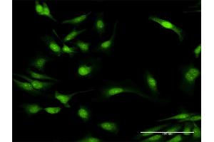 Immunofluorescence of purified MaxPab antibody to MYD88 on HeLa cell. (MYD88 抗体  (AA 1-296))