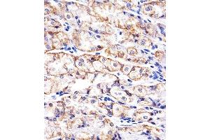 Immunohistochemistry (Paraffin-embedded Sections) (IHC (p)) image for anti-Cadherin 1, Type 1, E-Cadherin (Epithelial) (CDH1) antibody (ABIN4907853)