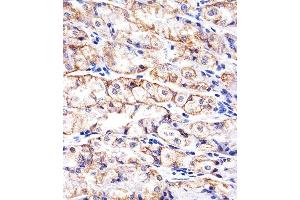 Paraformaldehyde-fixed, paraffin embedded human stomach tissue, Antigen retrieval by boiling in sodium citrate buffer (pH6. (E-cadherin 抗体)