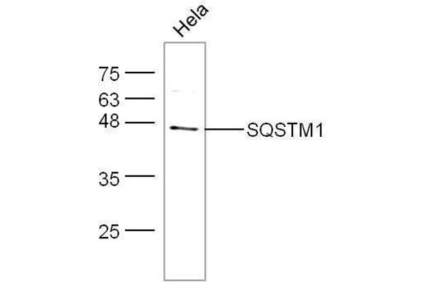 SQSTM1 抗体  (AA 51-150)