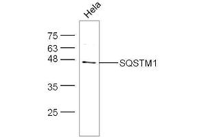 HeLa cell lysates probed with Anti-SQSTM1 Polyclonal Antibody, Unconjugated  at 1:5000 for 90 min at 37˚C. (SQSTM1 抗体  (AA 51-150))