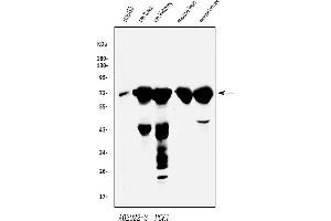 Western blot analysis of PCK1/PEPC using anti-PCK1/PEPC antibody (ABIN7599502).