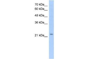 WB Suggested Anti-EMP2 Antibody Titration:  1. (EMP2 抗体  (Middle Region))