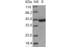 Western Blotting (WB) image for Cystatin F (Leukocystatin) (CST7) (Active) protein (Fc Tag) (ABIN7195337) (CST7 Protein (Fc Tag))