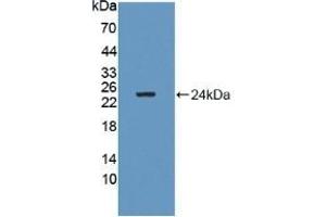 Detection of Recombinant GM2A, Human using Polyclonal Antibody to GM2 Ganglioside Activator (GM2A) (GM2A 抗体  (AA 24-193))