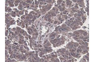 Immunohistochemistry (IHC) image for anti-Beclin 1, Autophagy Related (BECN1) antibody (ABIN2909625)
