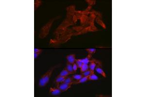 Immunofluorescence analysis of U2OS cells using NRAS Rabbit pAb (ABIN7267532) at dilution of 1:100 (40x lens). (GTPase NRas 抗体  (AA 1-189))