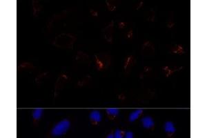 Immunofluorescence analysis of U-2 OS cells using ETHE1 Polyclonal Antibody at dilution of 1:100 (40x lens). (ETHE1 抗体)
