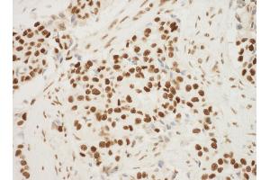 Immunohistochemistry (IHC) image for anti-Nucleophosmin (Nucleolar phosphoprotein B23, Numatrin) (NPM1) (AA 250-294) antibody (ABIN7448992) (NPM1 抗体  (AA 250-294))