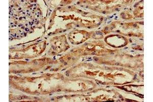 Immunohistochemistry of paraffin-embedded human kidney tissue using ABIN7175703 at dilution of 1:100 (WSB1 抗体  (AA 201-421))