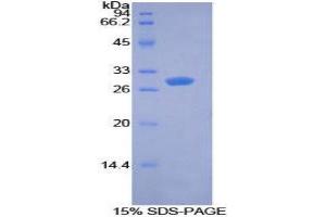 SDS-PAGE (SDS) image for Pyruvate Dehydrogenase Kinase 1 (PDK1) (AA 172-399) protein (His tag) (ABIN1878476)