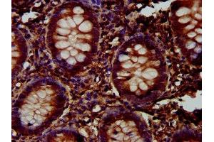 IHC image of ABIN7157790 diluted at 1:300 and staining in paraffin-embedded human appendix tissue performed on a Leica BondTM system. (FUK 抗体  (AA 579-758))