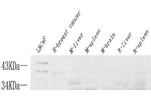 Western Blot analysis of various samples using FASLG Polyclonal Antibody at dilution of 1:1000. (FASL 抗体)