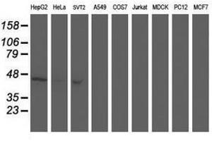 Image no. 5 for anti-Aminoacylase 1 (ACY1) antibody (ABIN1496454) (Aminoacylase 1 抗体)