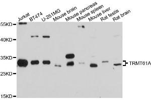 Western blot analysis of extracts of various cell lines, using TRMT61A antibody. (TRMT61A 抗体)