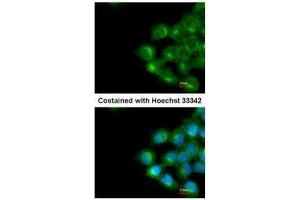 ICC/IF Image Immunofluorescence analysis of methanol-fixed A431, using Scramblase1, antibody at 1:200 dilution. (PLSCR1 抗体)