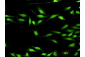 Immunofluorescence of purified MaxPab antibody to DGKZ on HeLa cell. (DGKZ 抗体  (AA 1-929))