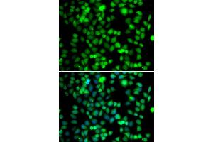 Immunofluorescence analysis of U20S cell using FKBP6 antibody. (FKBP6 抗体)