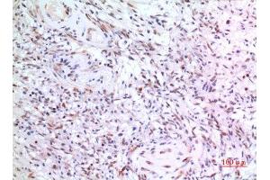Immunohistochemistry (IHC) image for anti-Zinc Finger Protein 307 (ZKSCAN4) (Internal Region) antibody (ABIN3187831)