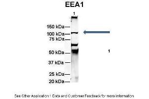 Amount and Sample Type :  500 ug rat brain homogenate  Amount of IP Antibody :  6 ug  Primary Antibody :  EEA1  Primary Antibody Dilution :  1:500  Secondary Antibody :  Goat anti-rabbit Alexa-Fluor 594  Secondary Antibody Dilution :  1:5000  Gene Name :  EEA1  Submitted by :  Dr. (EEA1 抗体  (N-Term))