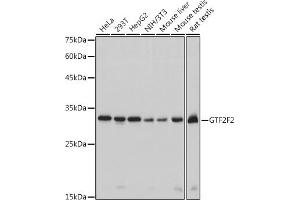 Western blot analysis of extracts of various cell lines, using GTF2F2 antibody (ABIN7267373) at 1:1000 dilution. (GTF2F2 抗体)