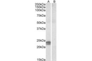 Western Blotting (WB) image for anti-High Mobility Group AT-Hook 1 (HMGA1) (Internal Region) antibody (ABIN2464248) (HMGA1 抗体  (Internal Region))