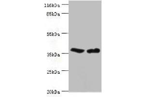 Western blot All lanes: CA5B antibody at 2 μg/mL Lane 1: Mouse liver tissue Lane 2: Mouse kidney tissue Secondary Goat polyclonal to rabbit IgG at 1/10000 dilution Predicted band size: 36 kDa Observed band size: 36 kDa (CA5B 抗体  (AA 34-314))