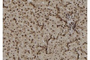 Immunohistochemistry (IHC) image for anti-Dual Specificity Phosphatase 4 (DUSP4) (Internal Region) antibody (ABIN6263269)