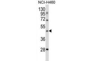 Western Blotting (WB) image for anti-Transducin-Like Enhancer of Split 6 (TLE6) antibody (ABIN2997351) (TLE6 抗体)