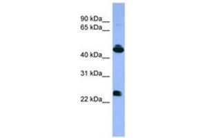 OPN1MW 抗体  (C-Term)