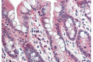 Immunohistochemistry (IHC) image for anti-Proteasome (Prosome, Macropain) Subunit, beta Type 10 (PSMB10) (Internal Region) antibody (ABIN571002)