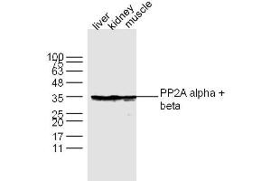 Lane 1: Liver lysates Lane 2: Kidney lysates Lane 3: Muscle lysates probed with PP2A alpha + beta Polyclonal Antibody, Unconjugated  at 1:300 dilution and 4˚C overnight incubation. (PP2A alpha/beta 抗体  (AA 205-309))