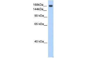 WB Suggested Anti-SCN5A Antibody Titration:  0. (SCN5A 抗体  (C-Term))